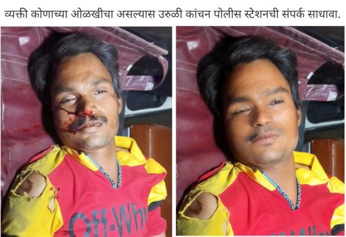 उरुळी कांचनमध्ये महामार्गावर भीषण अपघात! रिक्षातून उतरताना प्रवासी थेट 407 टेम्पोच्या चाकाखाली; जागीच मृत्यू ; मृताची ओळख पटवण्याचे आवाहन 